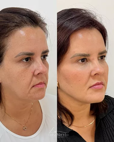 posts-luisa-1-6a2aa9a0a2615